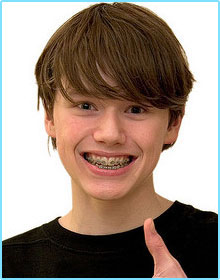 orthodontic faq